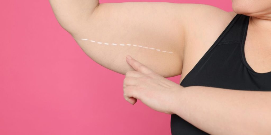 bras-flasques